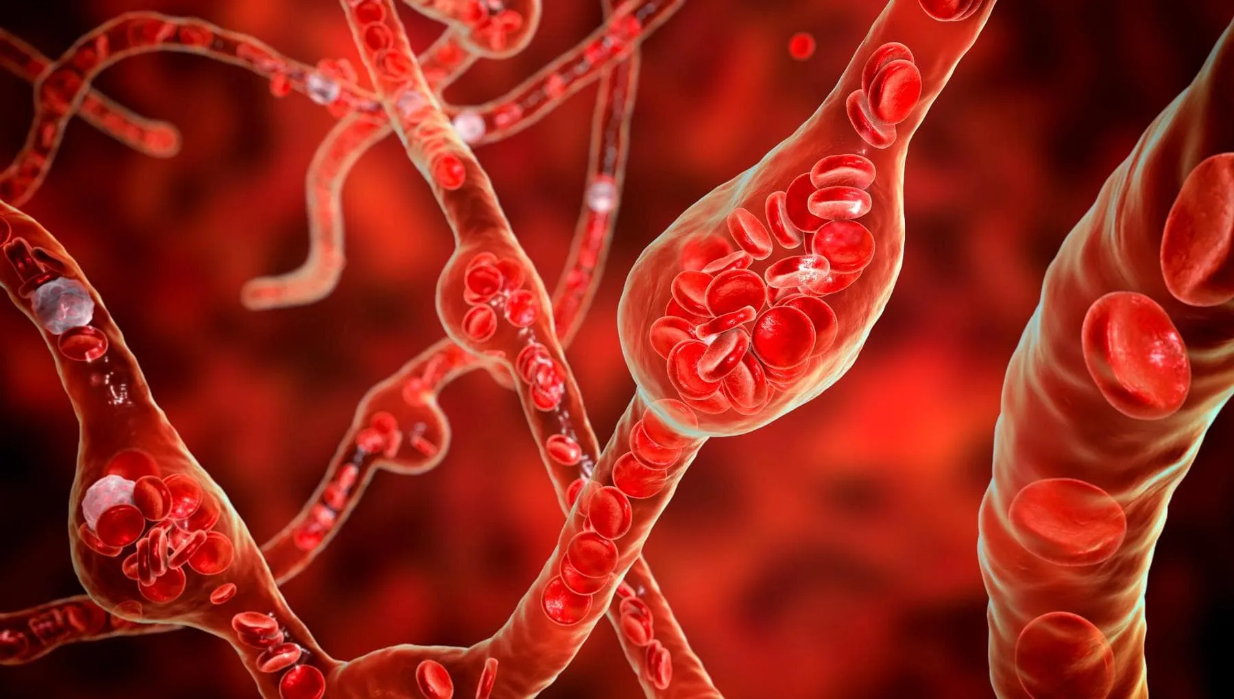 Aneurismi, svelato il meccanismo che rompe le arterie