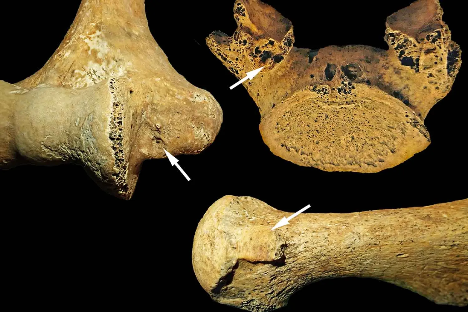 Sepolta come un uomo: tomba di 7000 anni fa dimostra che i ruoli di genere flessibili esistevano già nel Neolitico