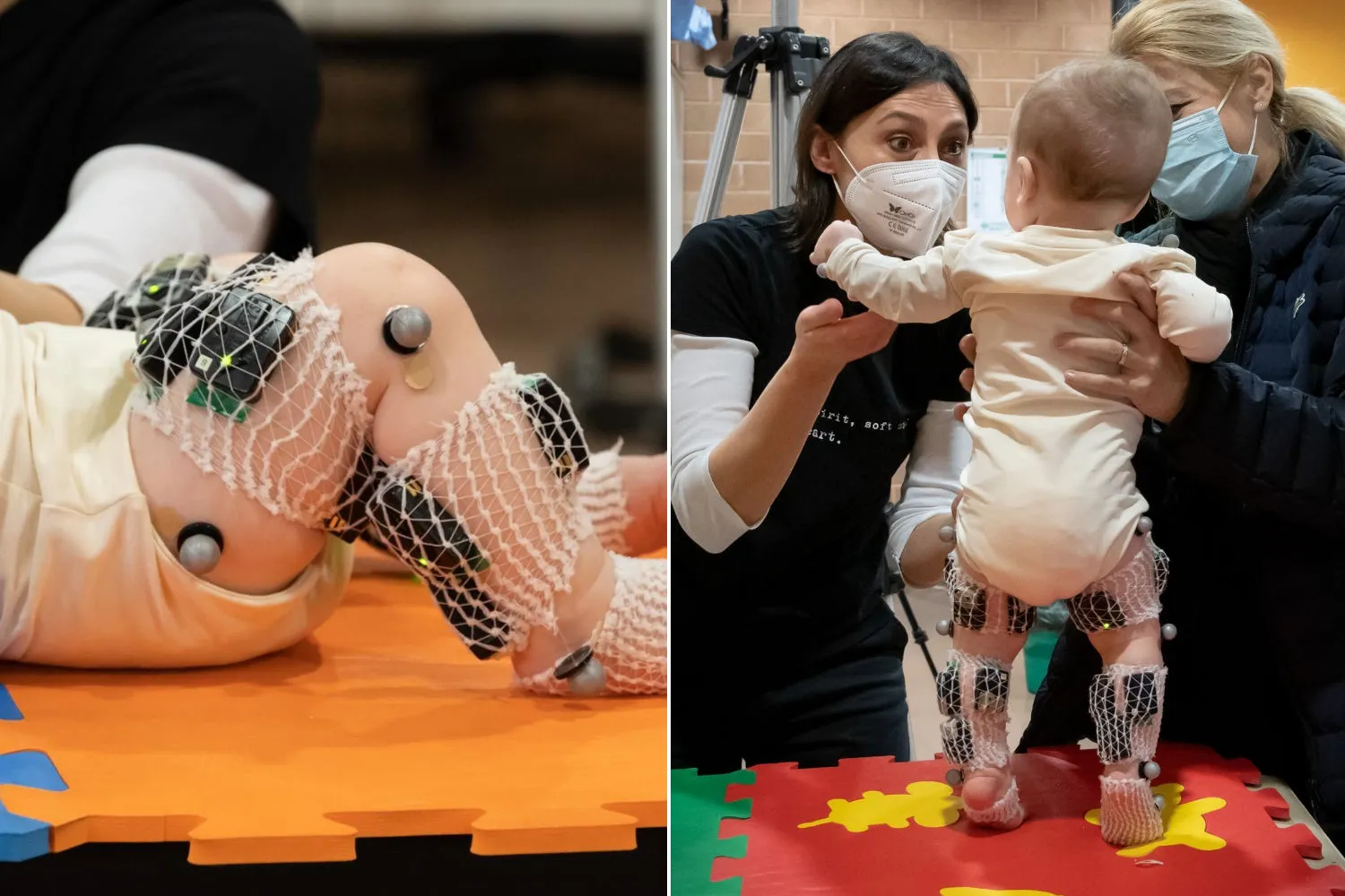 Speranza per la paralisi cerebrale infantile: così 34 bambini hanno imparato a camminare grazie agli elettrodi