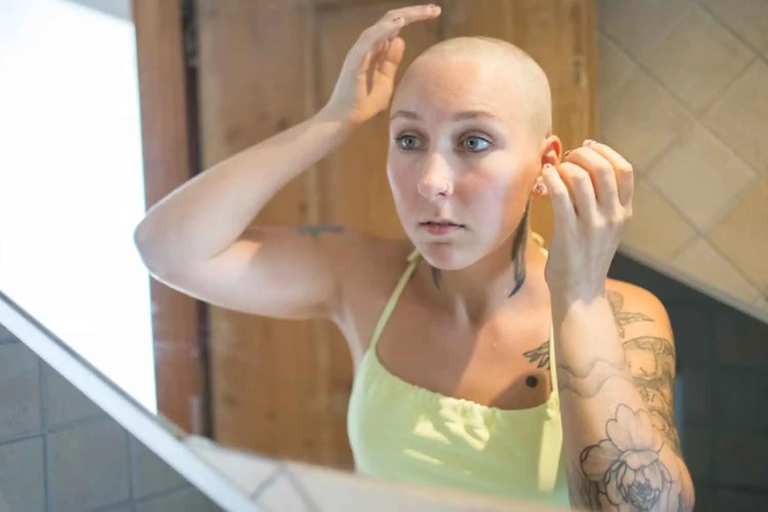 Alopecia: questo comune farmaco usato per l’artrite sta facendo ricrescere gran parte dei capelli a 1400 pazienti