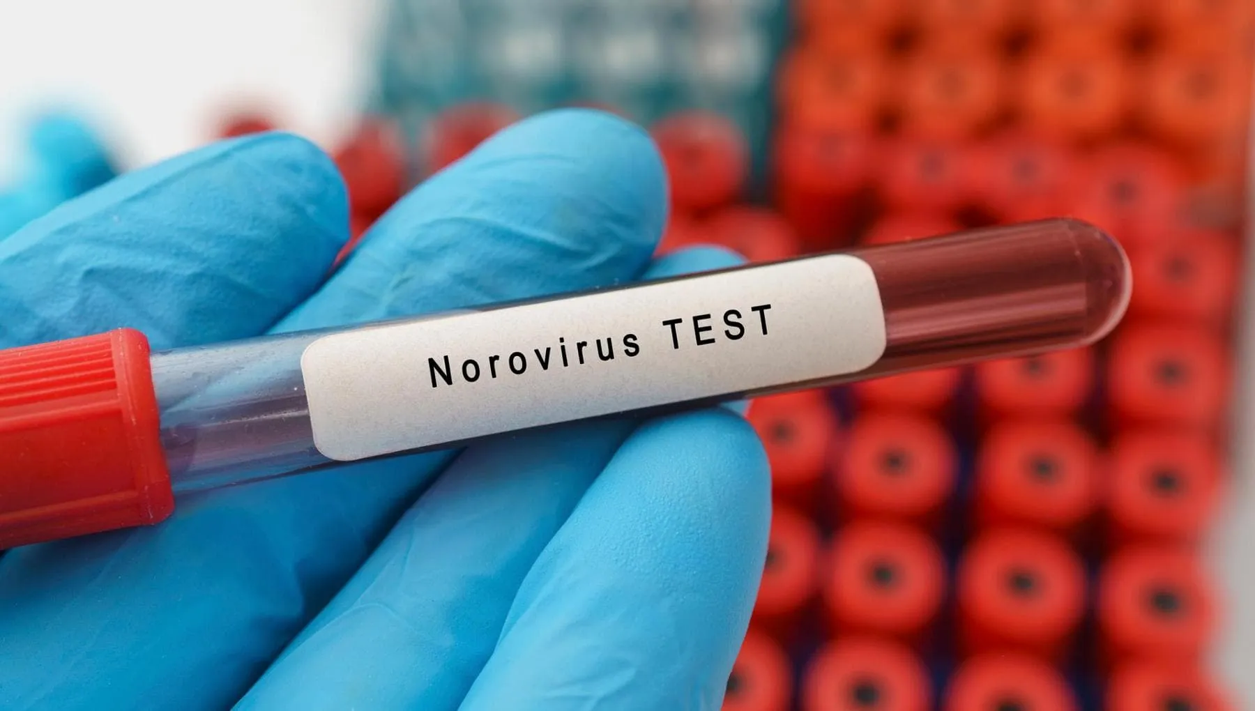 Norovirus, che cos’è e come si trasmette