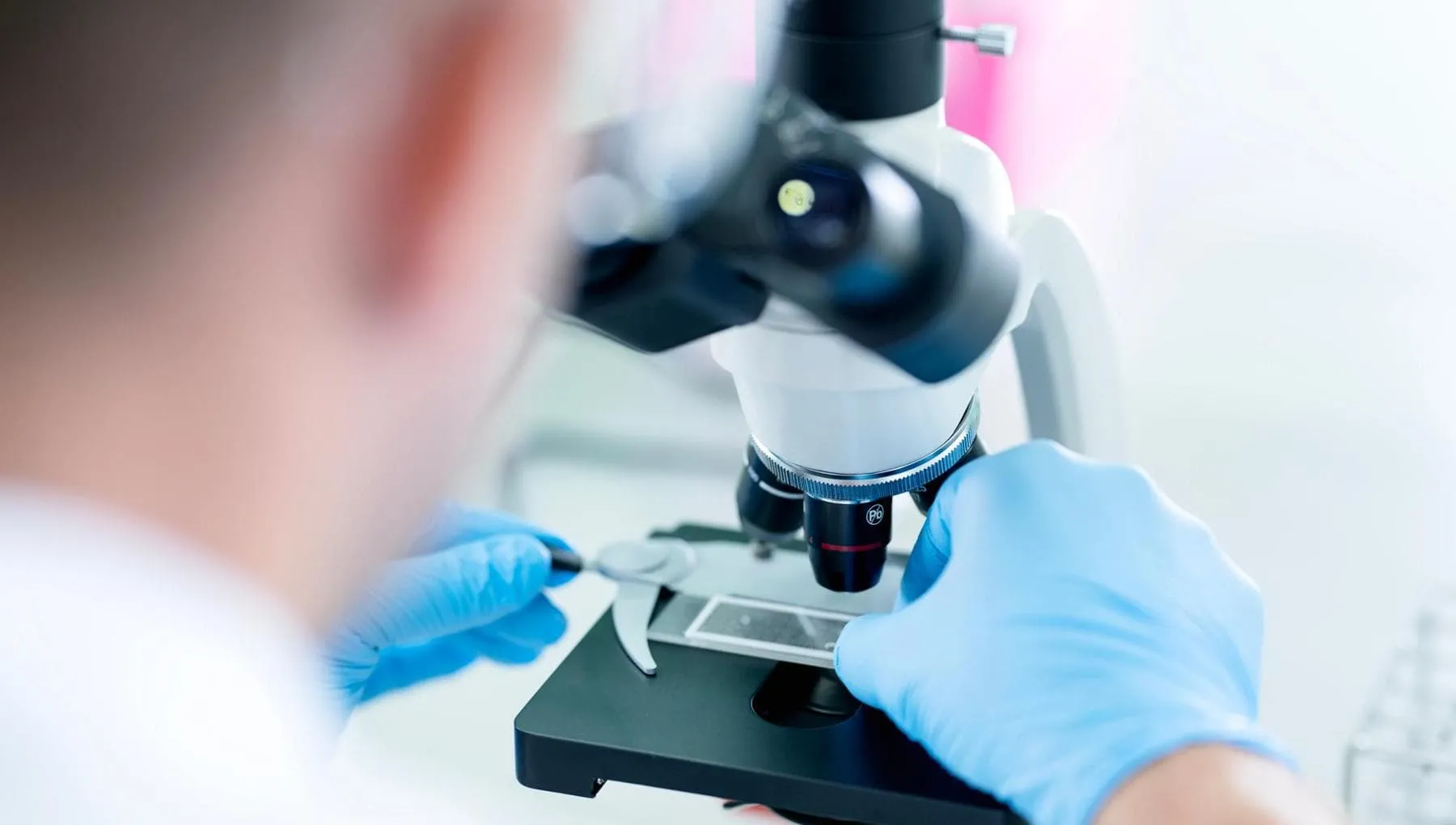 I farmaci anti-obesità potrebbero ridurre il rischio di metastasi in quattro tumori