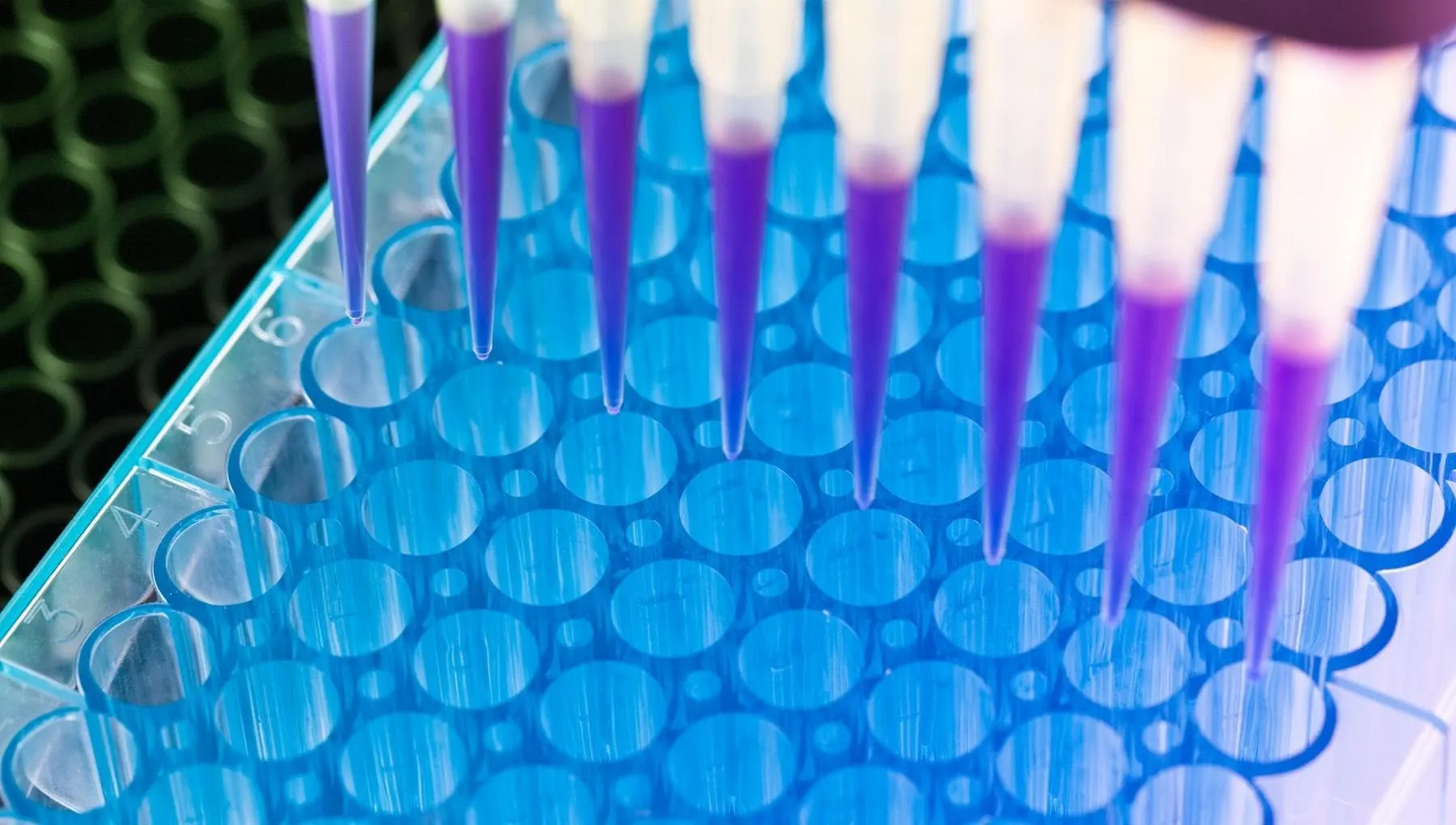 Tumore al pacreas: allo studio nuovo test per la diagnosi precoce nel sangue