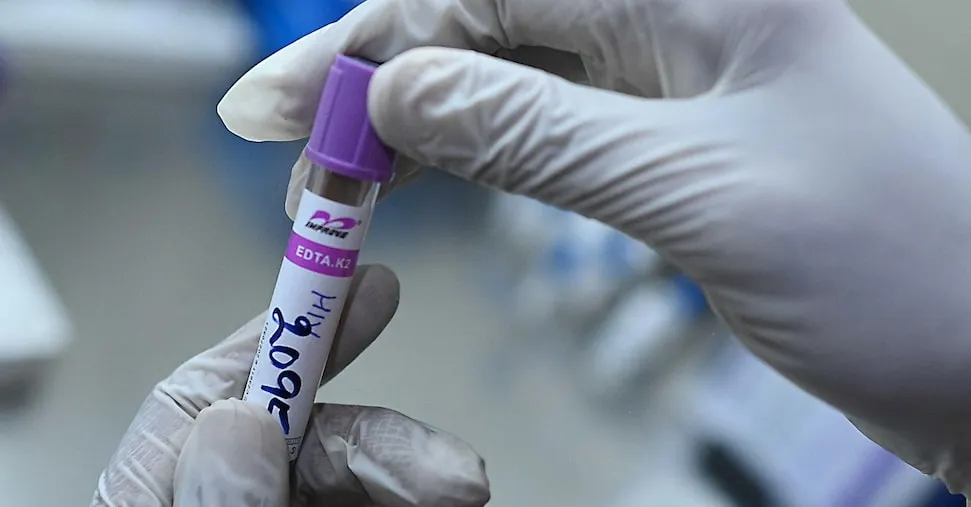 Malattia e longevità: un test del sangue  svela la nostra età biologica
