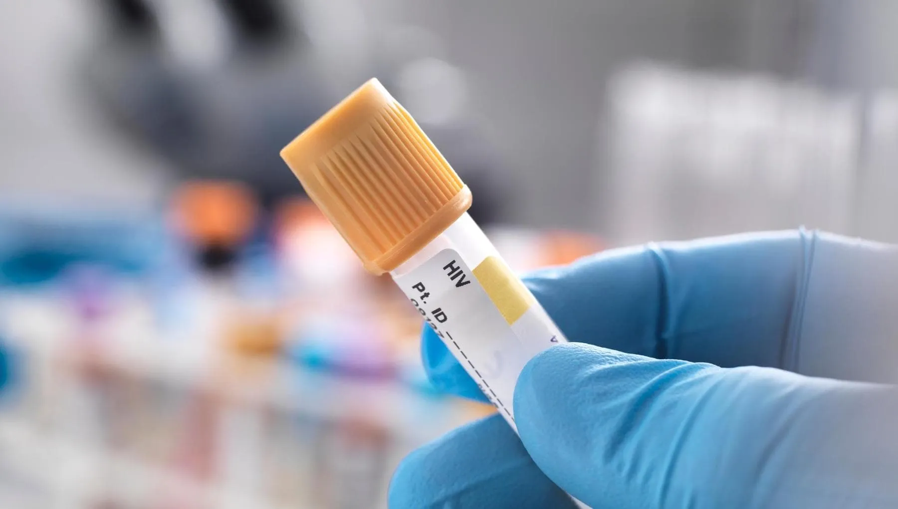 Hiv, la Prep a lunga durata anche in Italia: potrebbe migliorare l’aderenza alla terapia