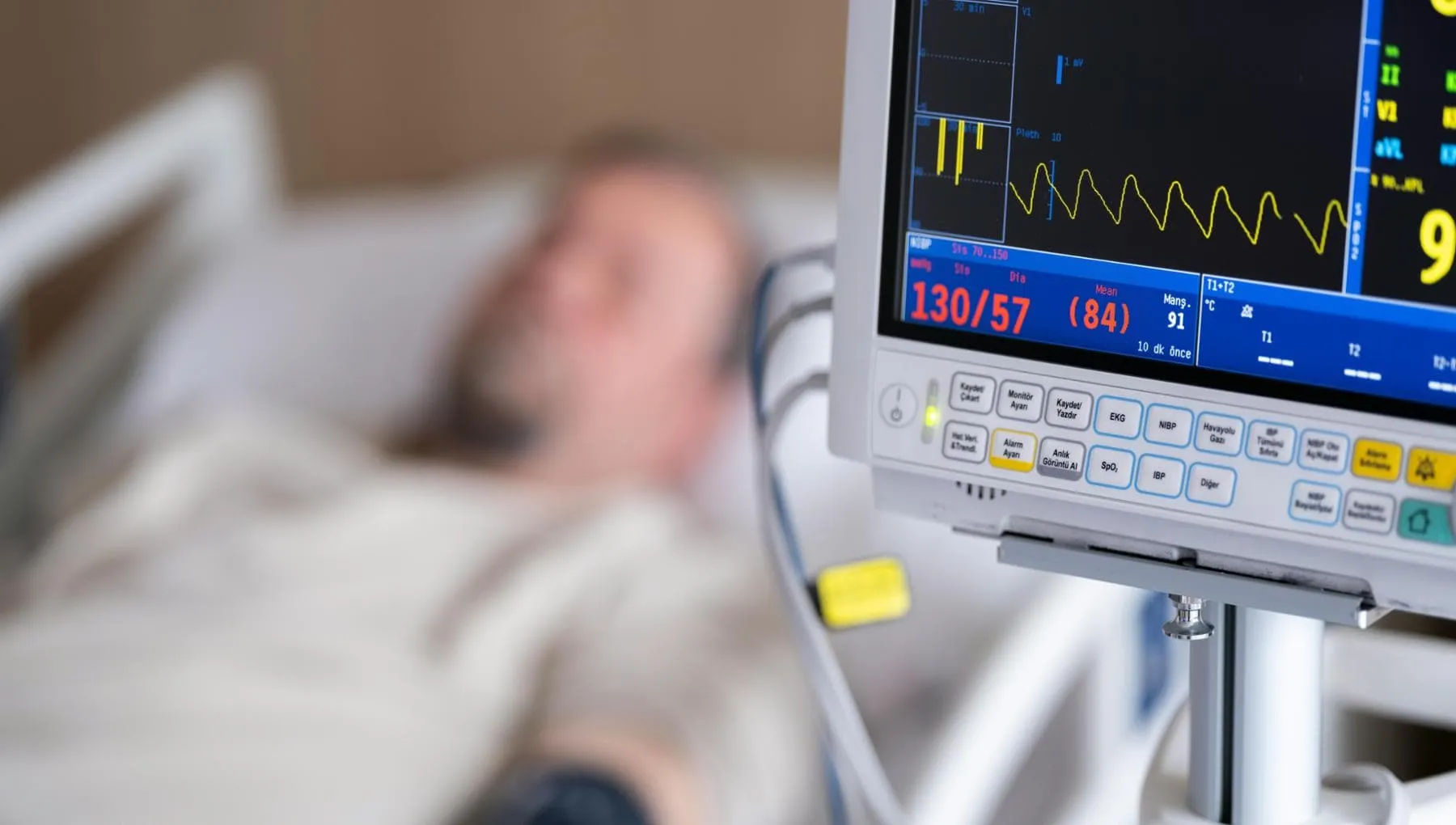 Ictus dopo una diagnosi di tumore: rischio 2,5 volte più alto nei primi tre mesi